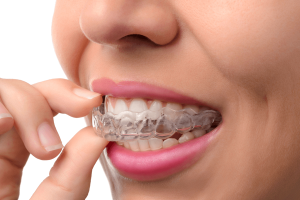 how much is invisalign without insurance